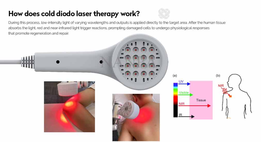 Cold-laser-Works.jpg